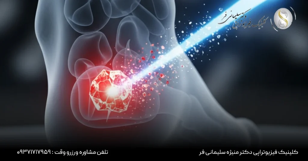 فیزیوتراپی برای درمان خارپاشنه